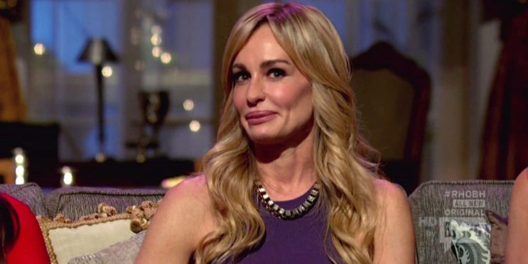 RHOBH: Taylor Armstrong’s Plastic Surgery Transformation In Photos