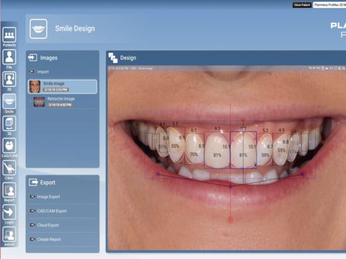 Photoshop AI thinks ‘happiness’ is a smile with rotten teeth