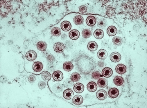 Link between herpesviruses and giant viruses no longer missing
