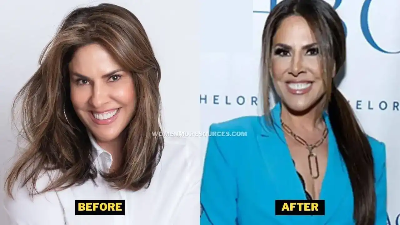 RHONJ: Jennifer Fessler’s Weight Loss & Facelift Before & After Photos