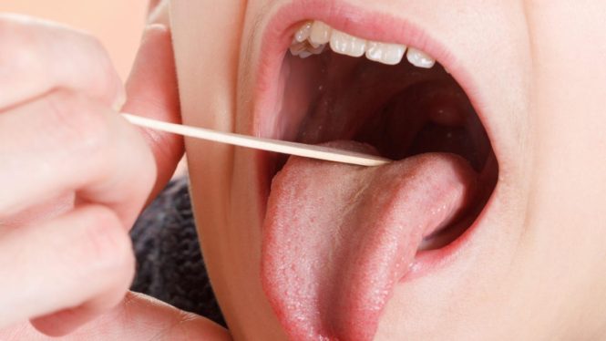 Strep Throat Is Surging, Alongside an Antibiotic Shortage