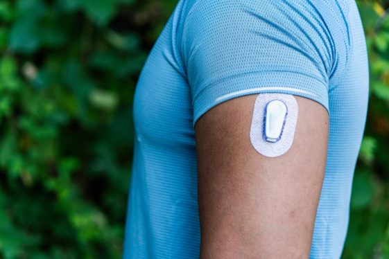 Why are non-diabetics suddenly wearing continuous glucose monitors?