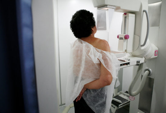 Breast Cancer Screenings May Cause Overdiagnosis in Older Women, Study Finds