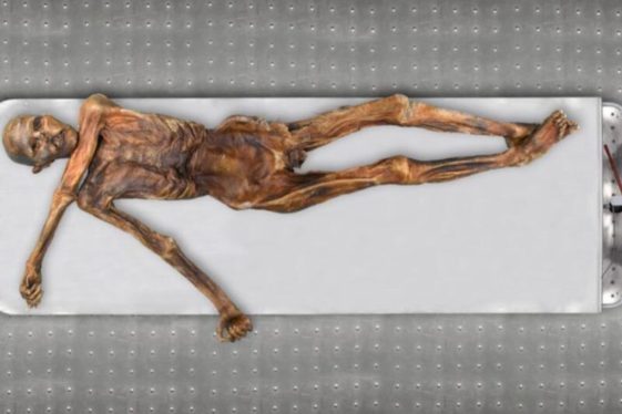 Surprise! Ötzi the Iceman was bald and had darker skin than presumed