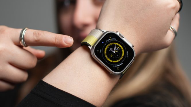 Apple Watch X: The 9 biggest things I want to see