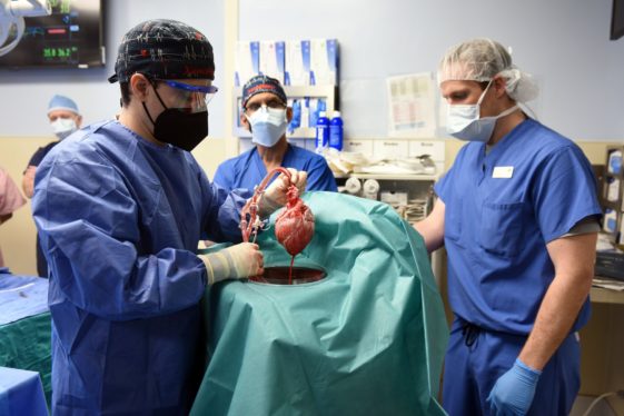 Genetically Modified Pig’s Heart Is Transplanted Into a Second Patient
