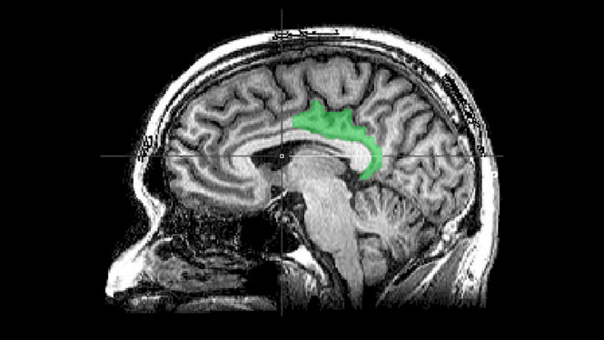 Brain Study Suggests Traumatic Memories Are Processed as Present Experience