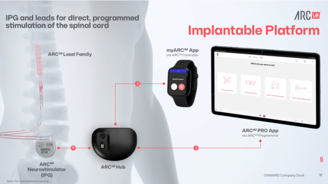 This spinal implant tech could restore mobility to Parkinsons patients