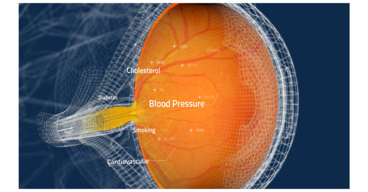 Toku’s AI platform predicts heart conditions by scanning inside your eye