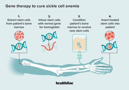 New Sickle Cell Therapies Will Be Out of Reach Where They Are Needed Most
