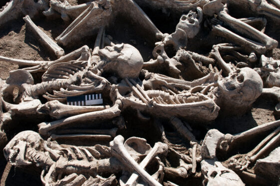 Ancient Skeletons Give Clues to Modern Medical Mysteries
