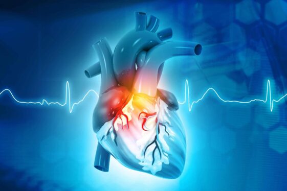Surprising link found between niacin and risk of heart attack and stroke