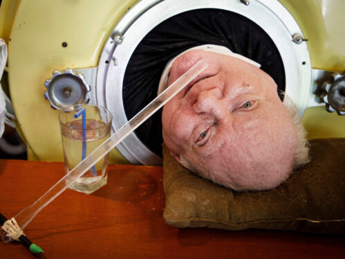 Paul Alexander, Polio Survivor Who Lived in Iron Lung for 72 Years, Dies age 78