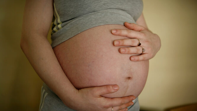 Teen Pregnancy Linked to Risk of Earlier Death in Adulthood, Study Finds