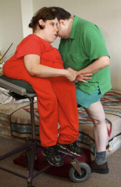 Lori and George Schappell, Long-Surviving Conjoined Twins, Die at 62