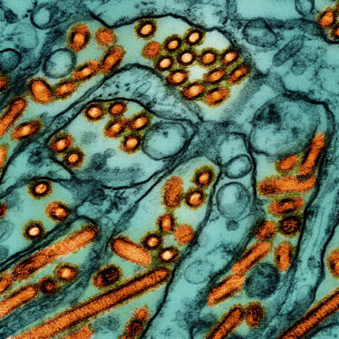 Human Infected With Bird Flu in Michigan, Only the Second Case of Current Outbreak