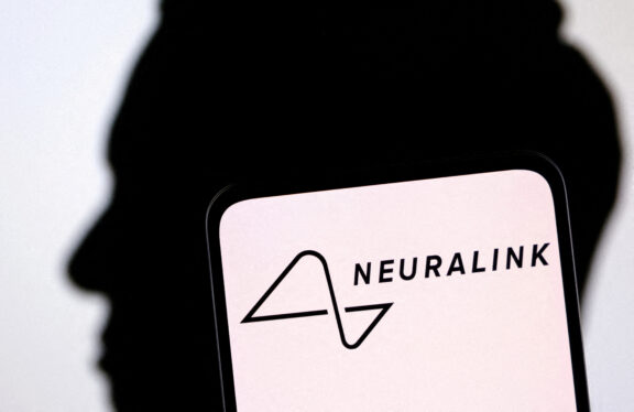 Setback Deals Blow to Neuralink’s First Brain Implant Patient, but He Stays Upbeat