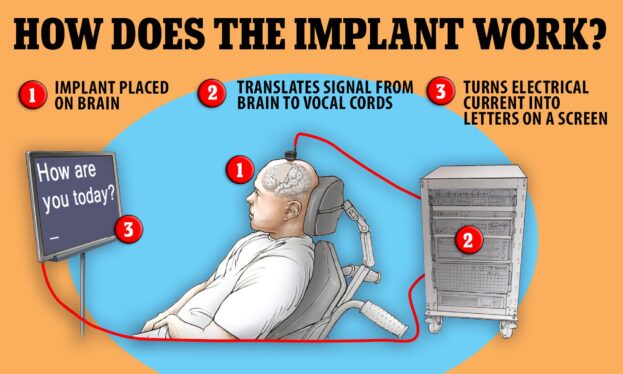 Single brain implant gives paralyzed man bilingual communication