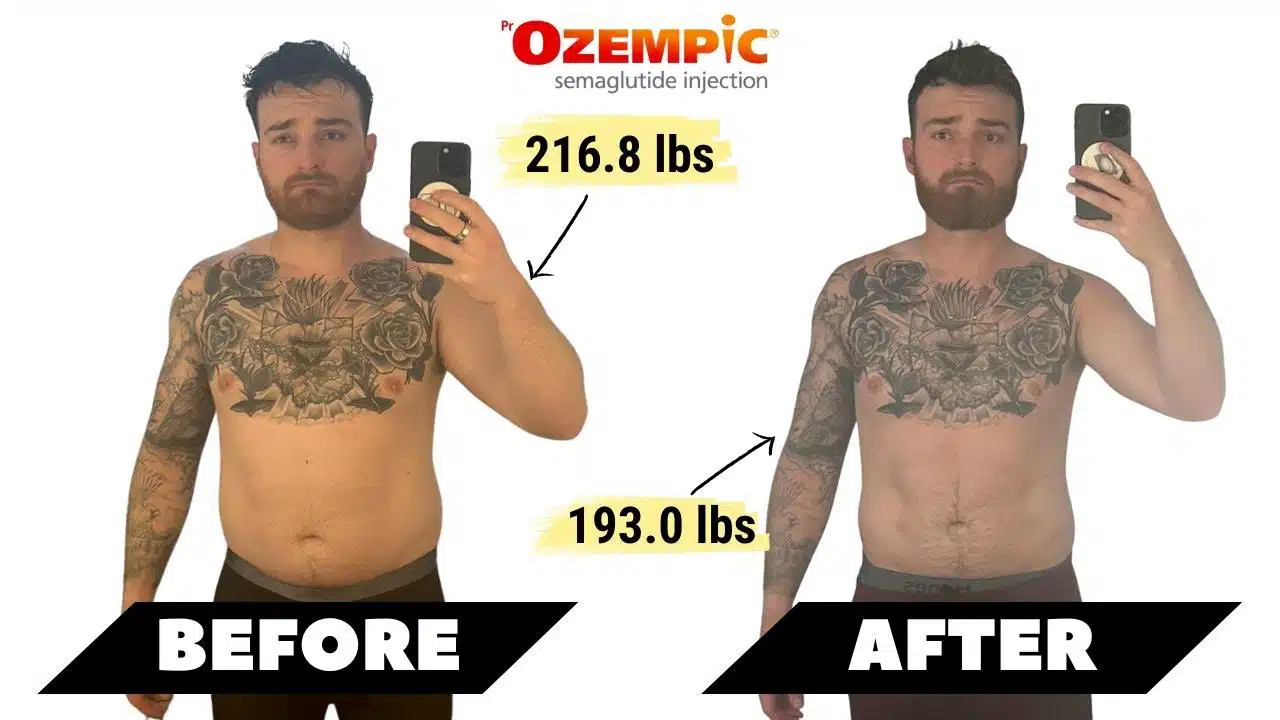 The Truth About Ozempic and Muscle Loss