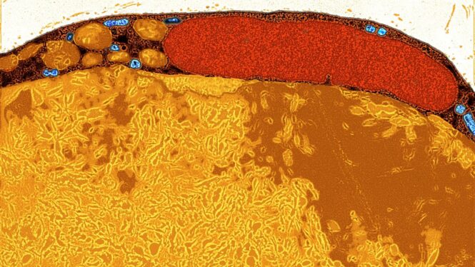 White Fat Cells Morphed Into Calorie-Burning Beige Fat Cells in New Experiment