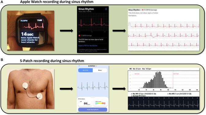 Google Intensifies Health Tracking With ‘Loss of Pulse Detection’