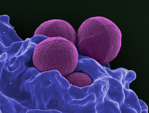 Dangerous Bacteria Actively Seek Out Human Blood, Scientists Discover