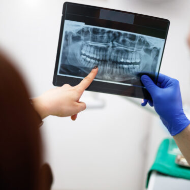 Routine dental X-rays are not backed by evidence—experts want it to stop