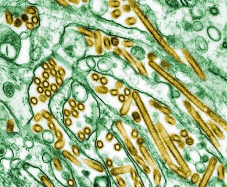 CDC Confirms First US Case of Severe Bird Flu